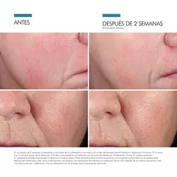 Phyto Corrective Essence Mist