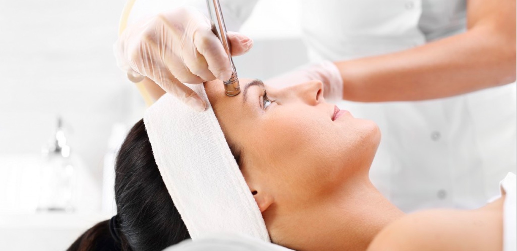 MICRODERMABRASIÓN