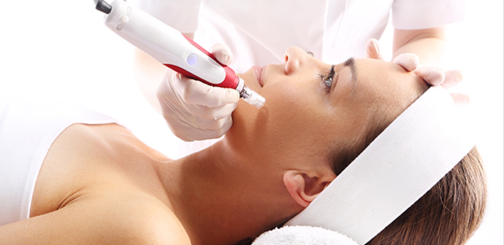 MICRODERMABRASIÓN