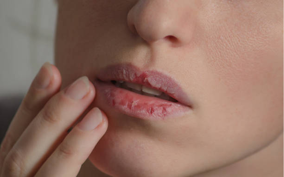 7-Consejos-para-Hidratar-los-Labios-Skinceuticals-2