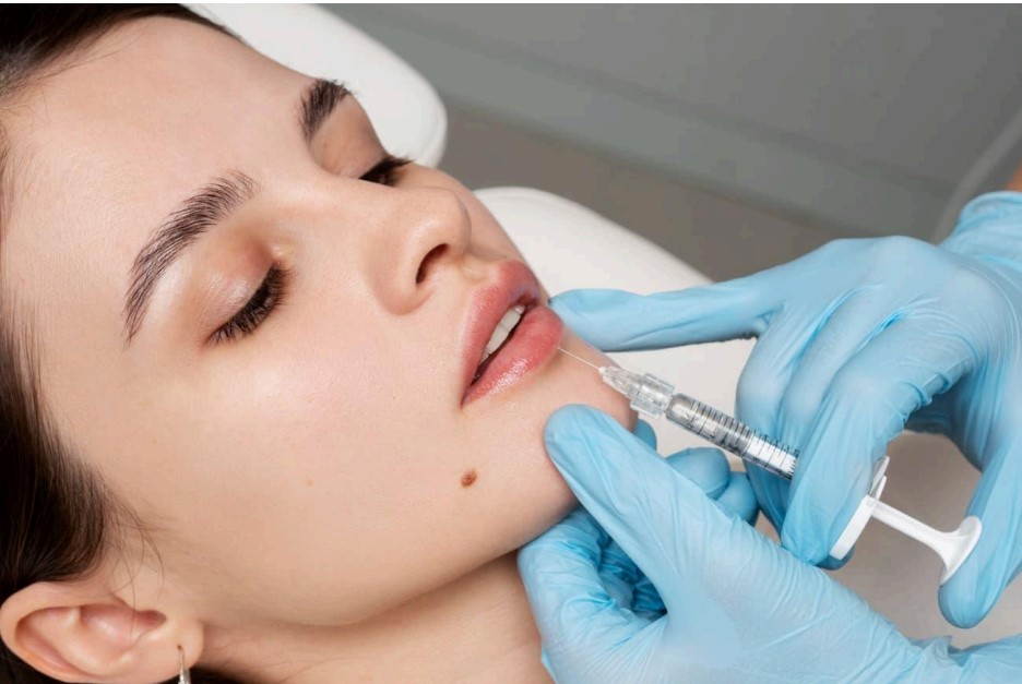 Mujer recibiendo un tratamiento estético en los labios, con una aguja y guantes azules en un entorno clínico.
