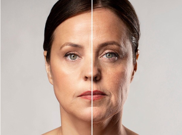 flacidez facial a los 50