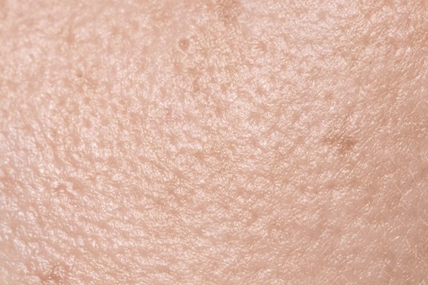 piel escamosa
