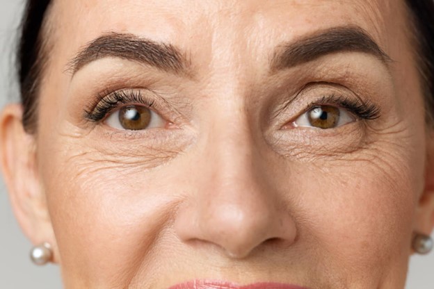 cómo prevenir las arrugas debajo de los ojos
