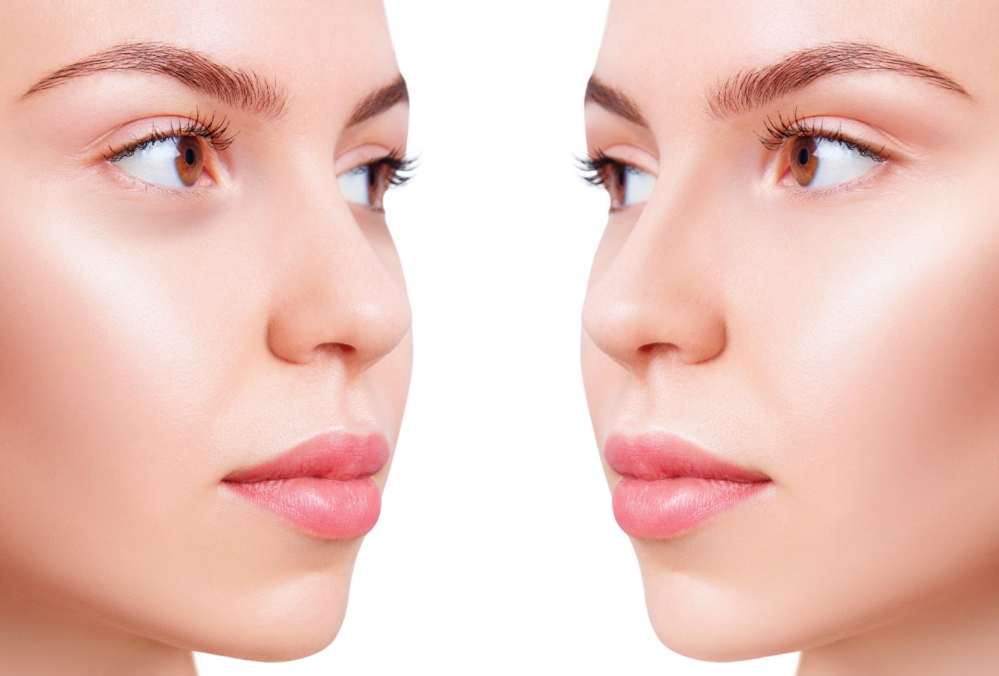 remedios para las ojeras