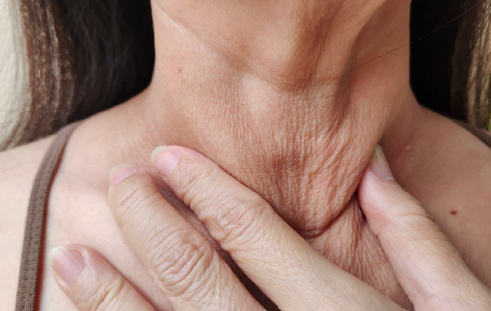 tratamiento-flacidez-facial