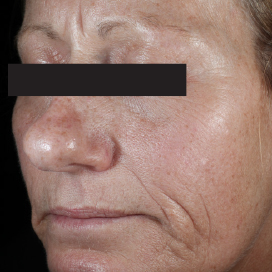 C E Ferulic® | Sérum con Vitamina C | SkinCeuticals